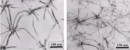 Figure 1.3: TEM-pictures of the gel-morphology of N-sorbitoyl-3,4,5-tris(dodecyloxy)benzamide (3 wt%) in (a) poly(hexylmethacrylate-cross-butanedioldimethacrylate) and (b) in poly(butylmethacrylate-cross-decanedioldimethacrylate)